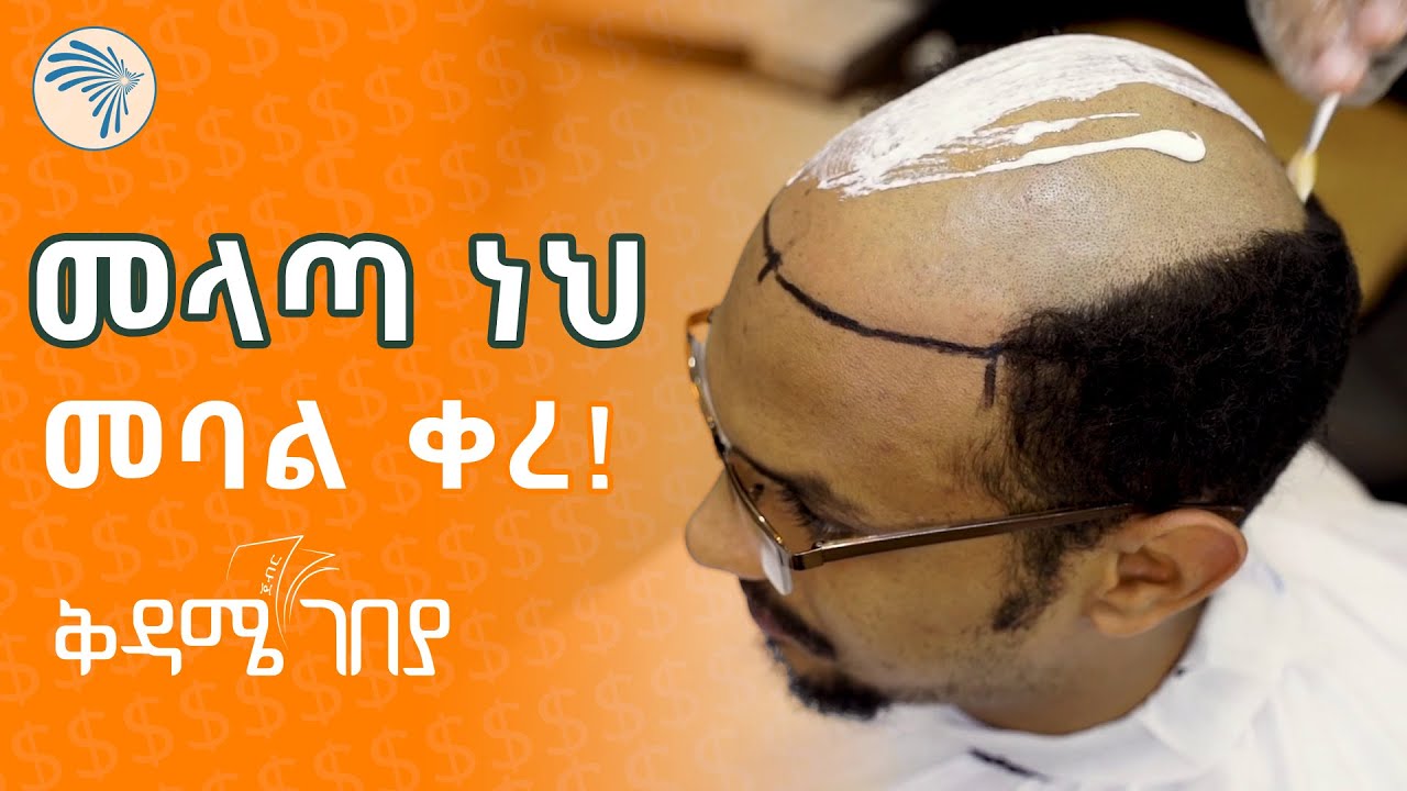 Embracing Baldness: Changing Perceptions in Modern Society