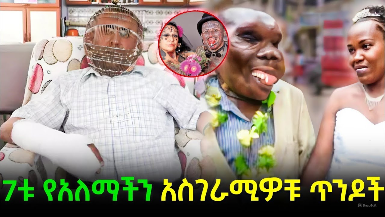 Extreme Measures: Man Locks His Head to Quit Smoking